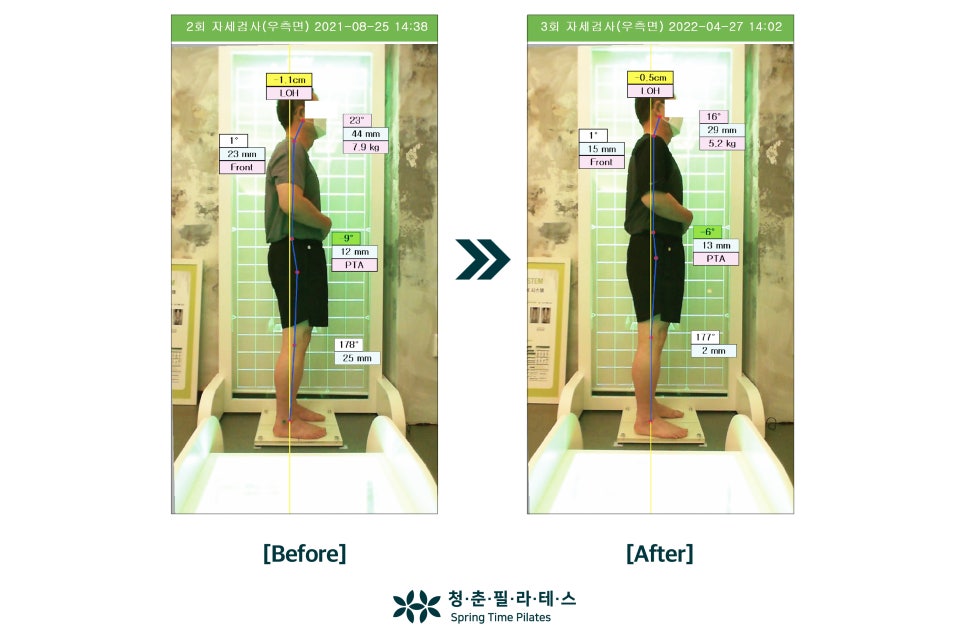 비포 애프터 비교