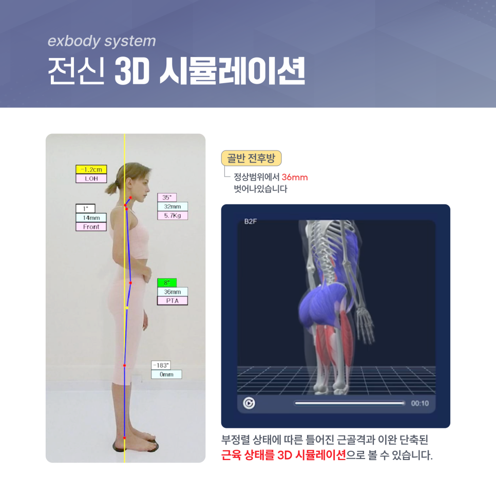 엑스바디 분석 화면2